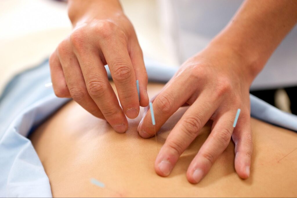 鍼灸 頻度