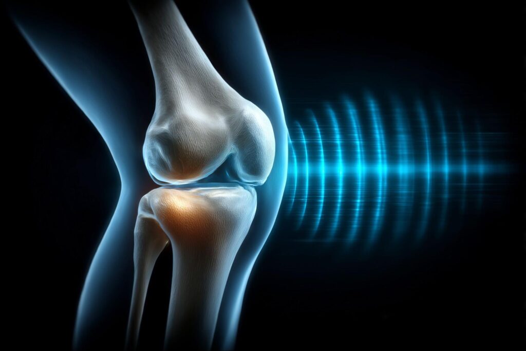 膝 曲げると痛い